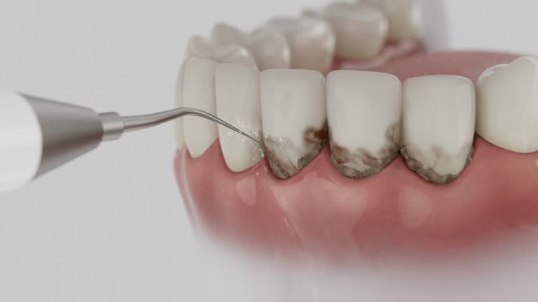 Reliable Dental Implants contractor in Alsip, IL by Smile Center Dentistry